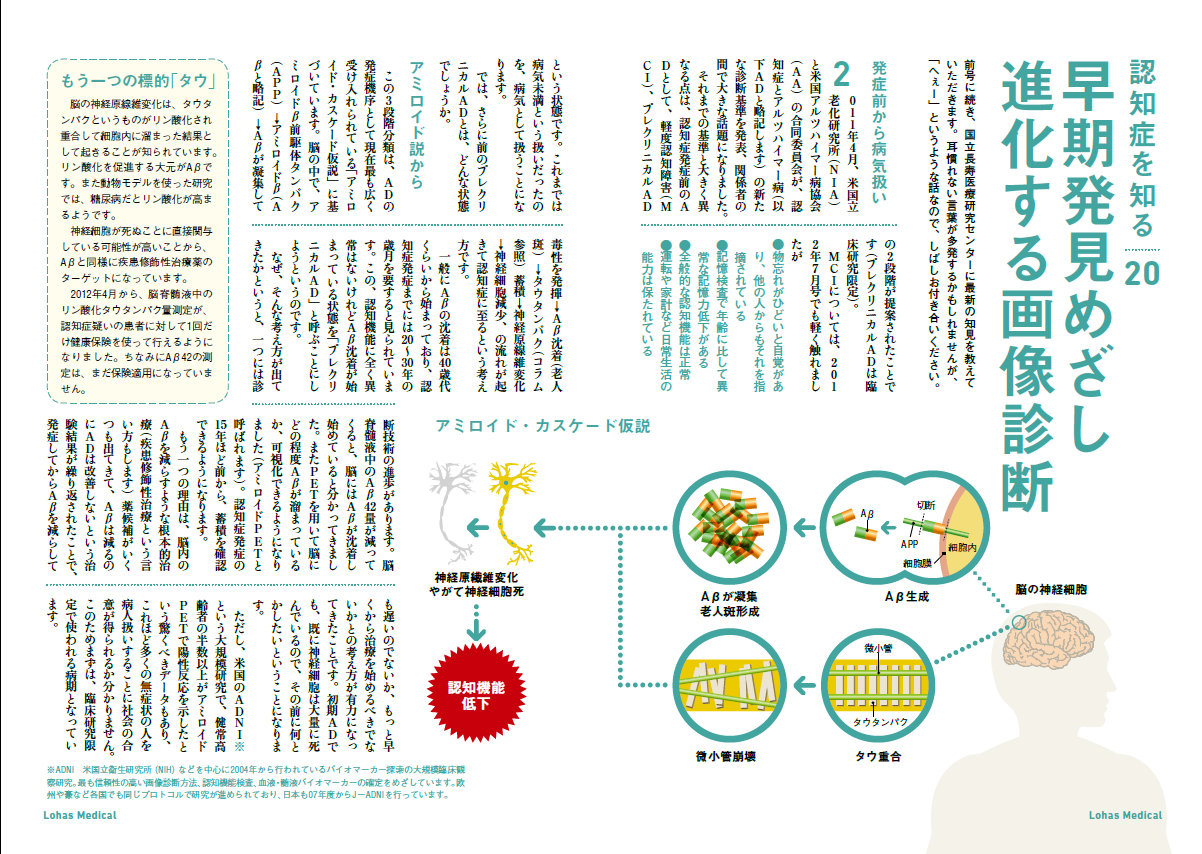 http://robust-health.jp/article/100-3-1.png