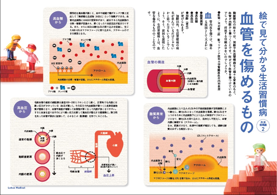 http://robust-health.jp/article/108-1-1.jpg