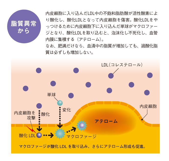 http://robust-health.jp/article/108_zuhan02.jpg