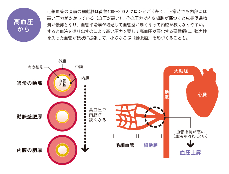 http://robust-health.jp/article/108_zuhan04.jpg