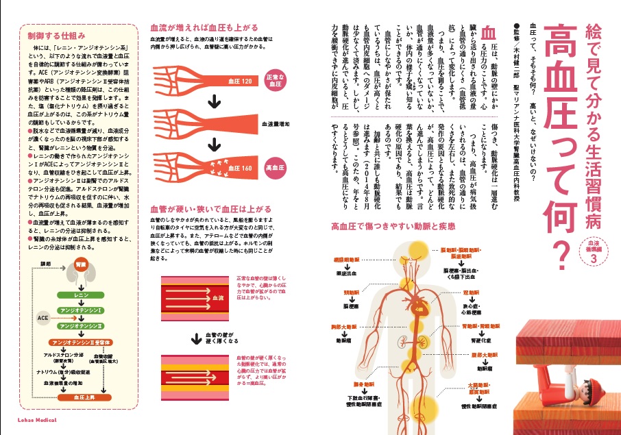 http://robust-health.jp/article/109-1-1.jpg