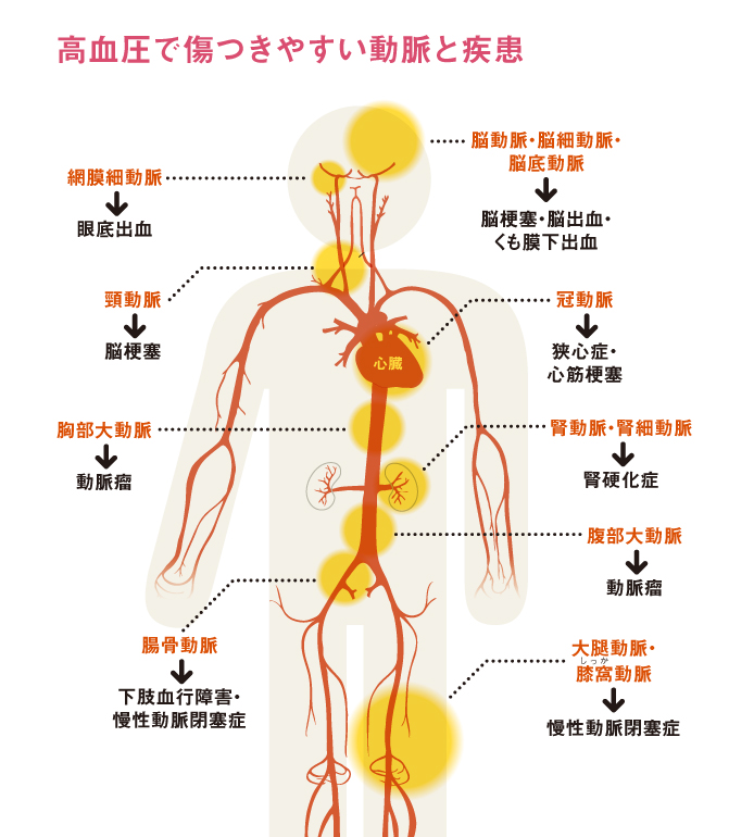 http://robust-health.jp/article/109_zuhan01.jpg