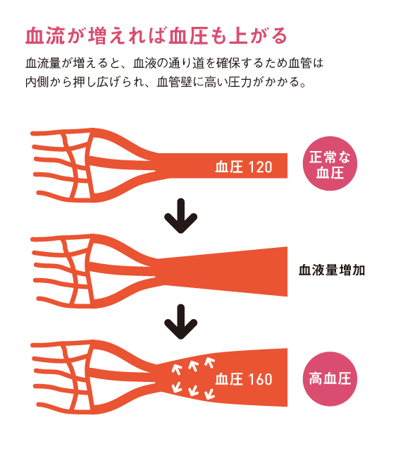 http://robust-health.jp/article/109_zuhan02.jpg