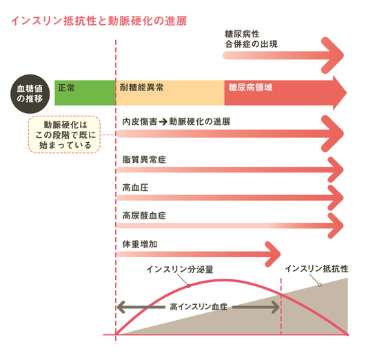 絵で見て分かる生活習慣病⑤ 高インスリン血症から生活習慣病へ｜ロハス・メディカル